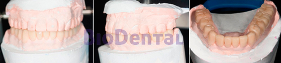 Estética y blanqueamiento dental 